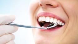 裝假牙、植牙都理賠，期滿領回七成！以為賺很大，「牙齒險」暗藏五地雷