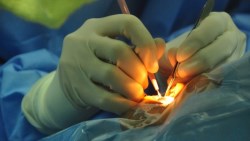 白內障動手術》注意！到「診所」或「大醫院」，保險理賠結果大不同