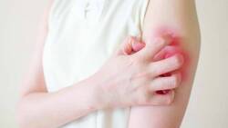   被蕁麻疹反覆糾纏？ 2種病因一次釐清，自費藥不一定是最優解方！